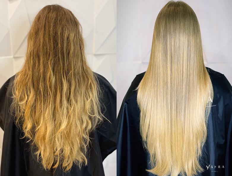 lisage fashion au botox